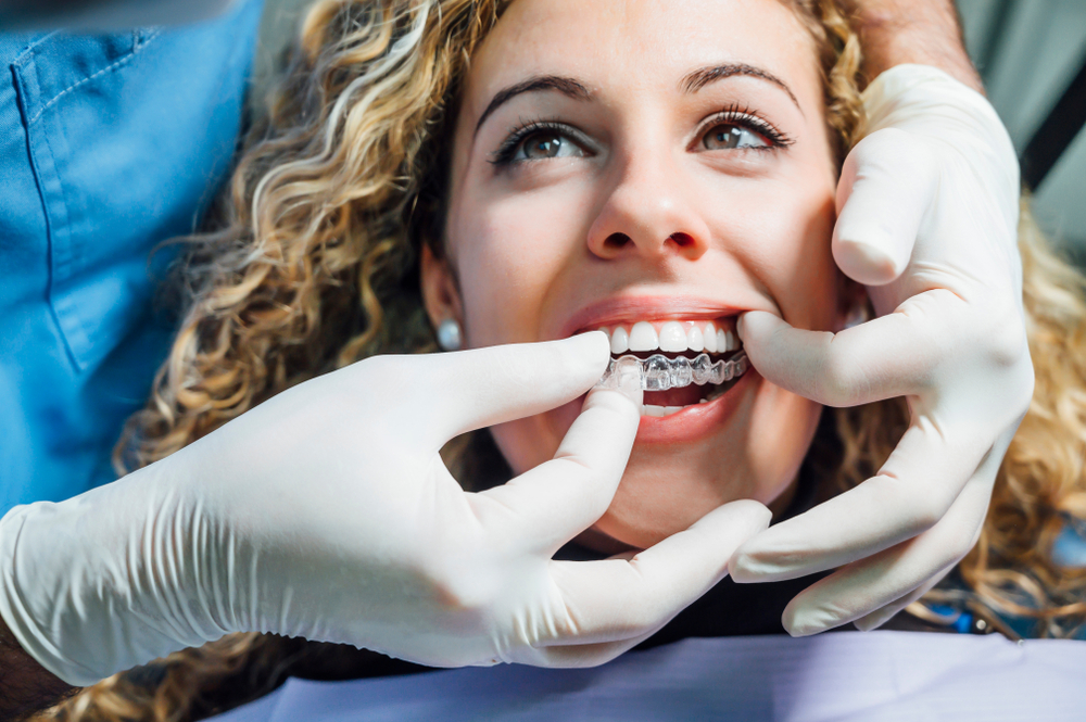 how invisalign works